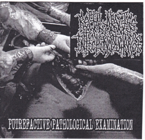 Rectal Abscess Infection Discharge : Putrefactive Pathological Examination